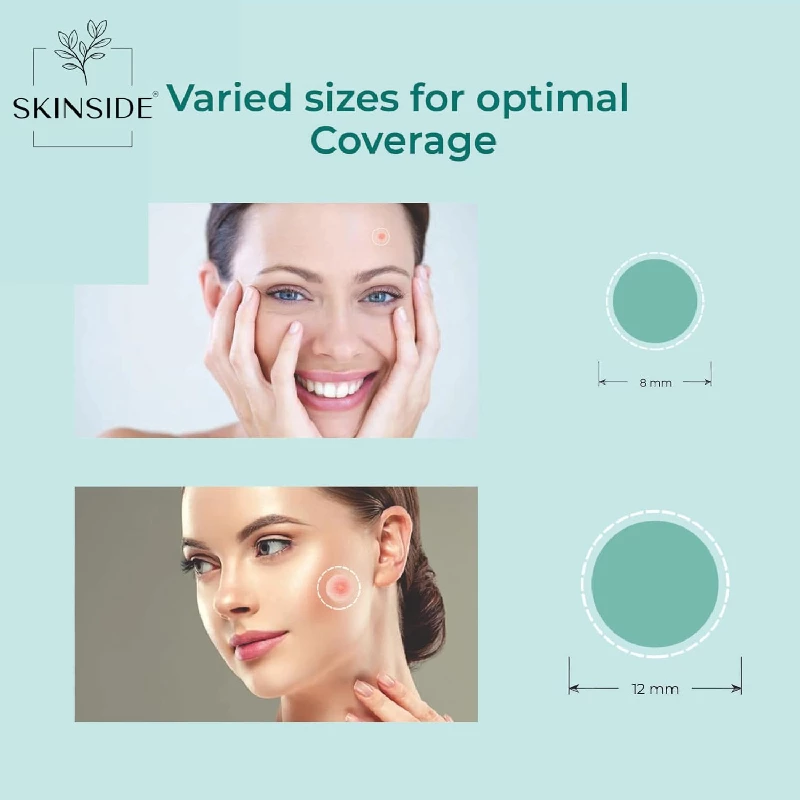 Skinside Acne Pimple Patches for Face Pimple, 72 Patches-2.webp